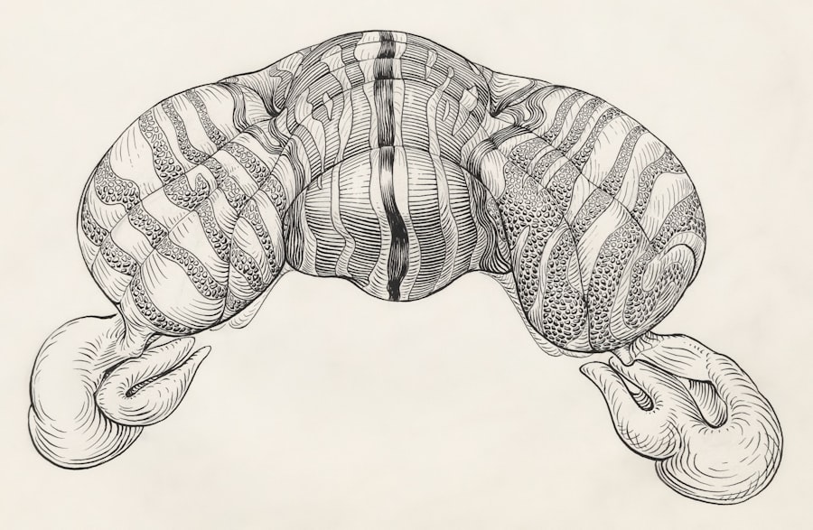 Legionellosis
