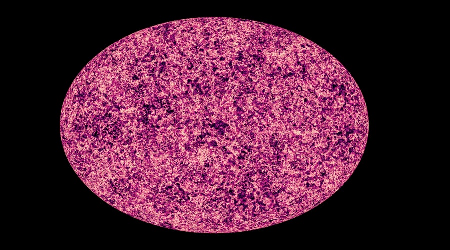 Photo Legionellosis